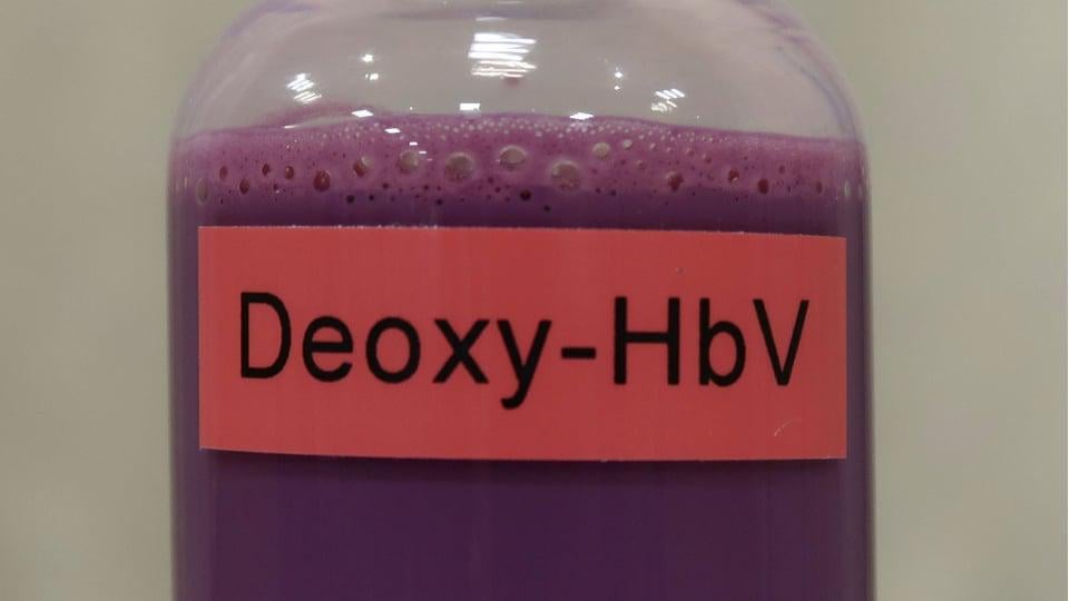 Japan pioneers type-free artificial red blood cells, offering a universal blood substitute that solves blood type incompatibility and transforms transfusion medicine
