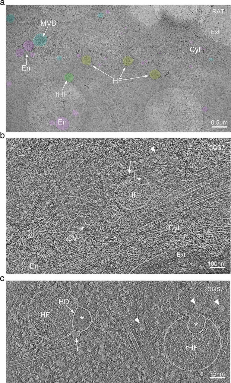 Scientists discover unknown organelle inside our cells