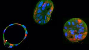 In a step toward treating mitochondrial diseases, researchers successfully edited harmful mutations in mitochondrial DNA using genetic tool known as base editor in human cells in the lab, restoring healthy mitochondrial function. The results offer new hope for people with rare genetic conditions.