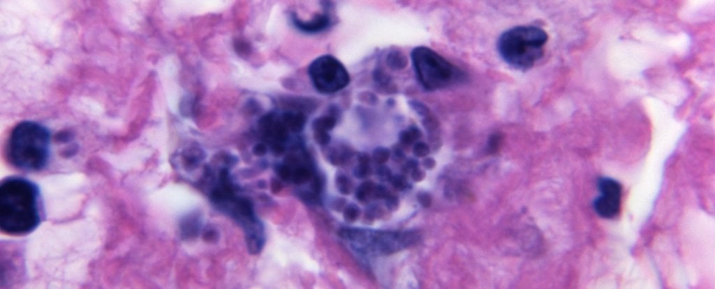Parasite Infecting Up to 50% of People Can Decapitate Human Sperm