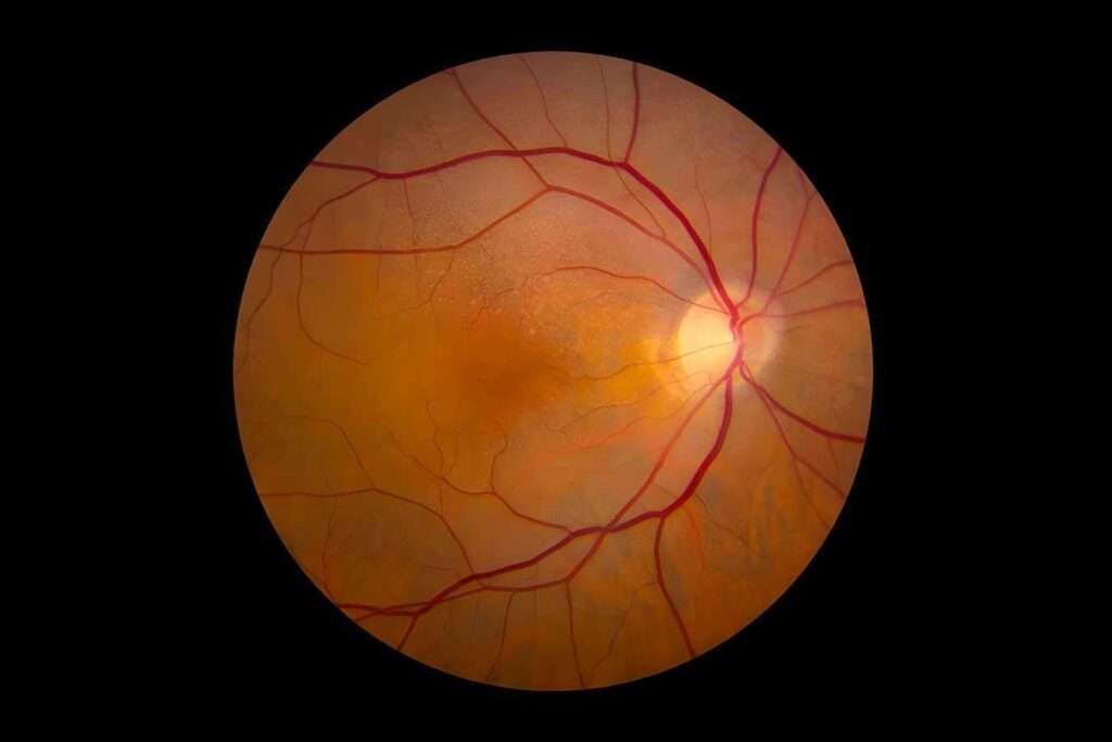 A retinal implant partly restored vision in blind mice, suggesting it could one day benefit people with certain kinds of blindness.