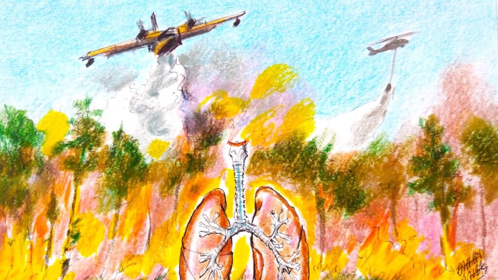 A nation mobilized: Türkiye’s relentless battle against forest fires