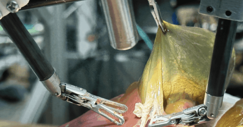 Autonomous robot surgeon removes organs with 100% success rate: world's first surgery performed by a robot responding and learning in real time. Its precision and skill matched that of experienced surgeons. It conducted a gallbladder removal on its own on a realistic human-like model.