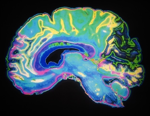 Innovative technologies push pediatric MRI beyond diagnostics