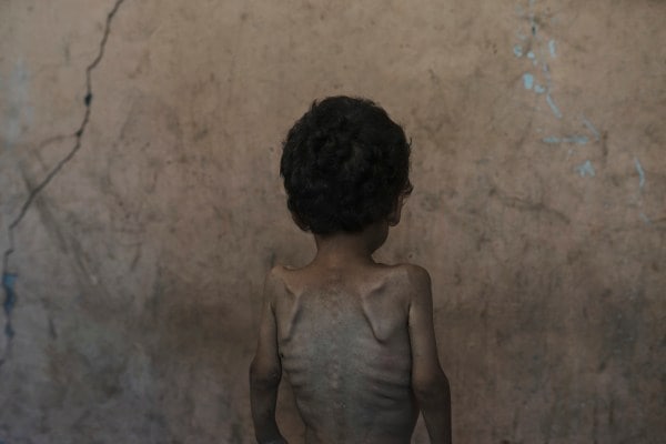 gaza starvation