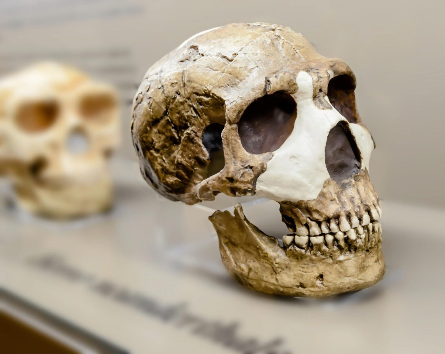 Neanderthal skull traits cause modern human brain problems