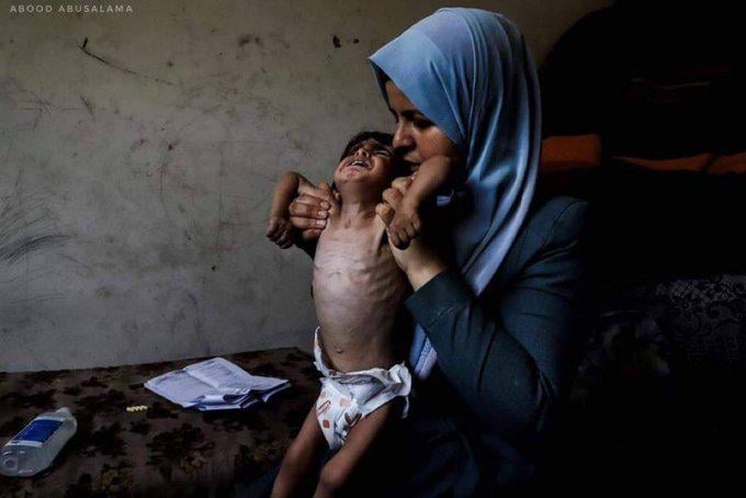 Le Monde: Israel prevents infants from entering infants dying from hunger
