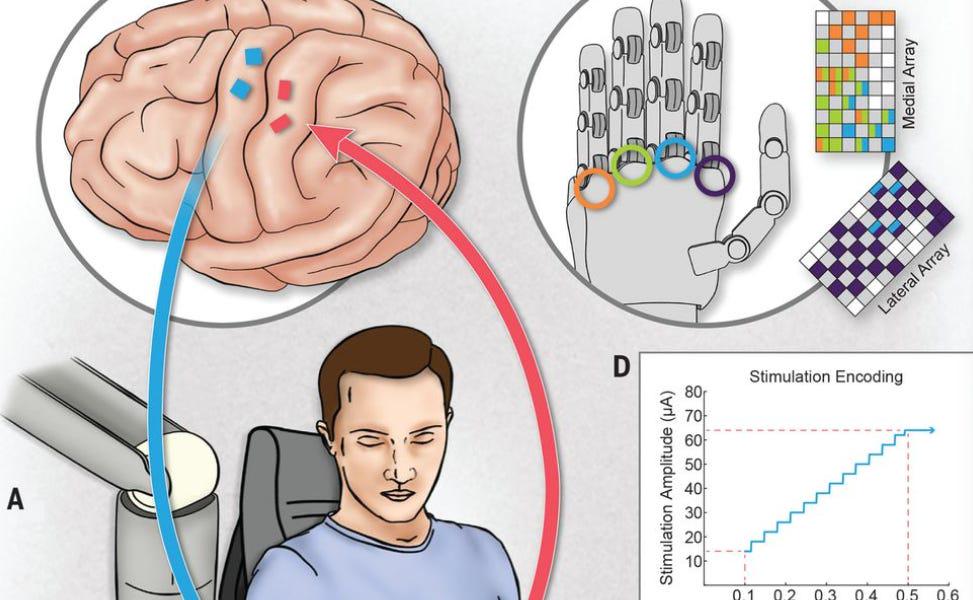 Cyborg obsolescence: Who owns and controls your brain implant?