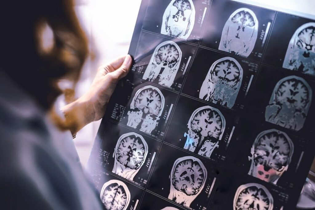 Multiple sclerosis could affect health years before classic symptoms
