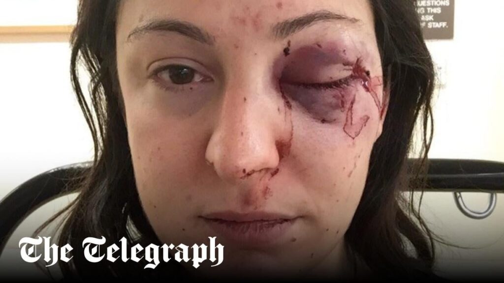 I stood up to shoplifters in Tesco. It ruined my life