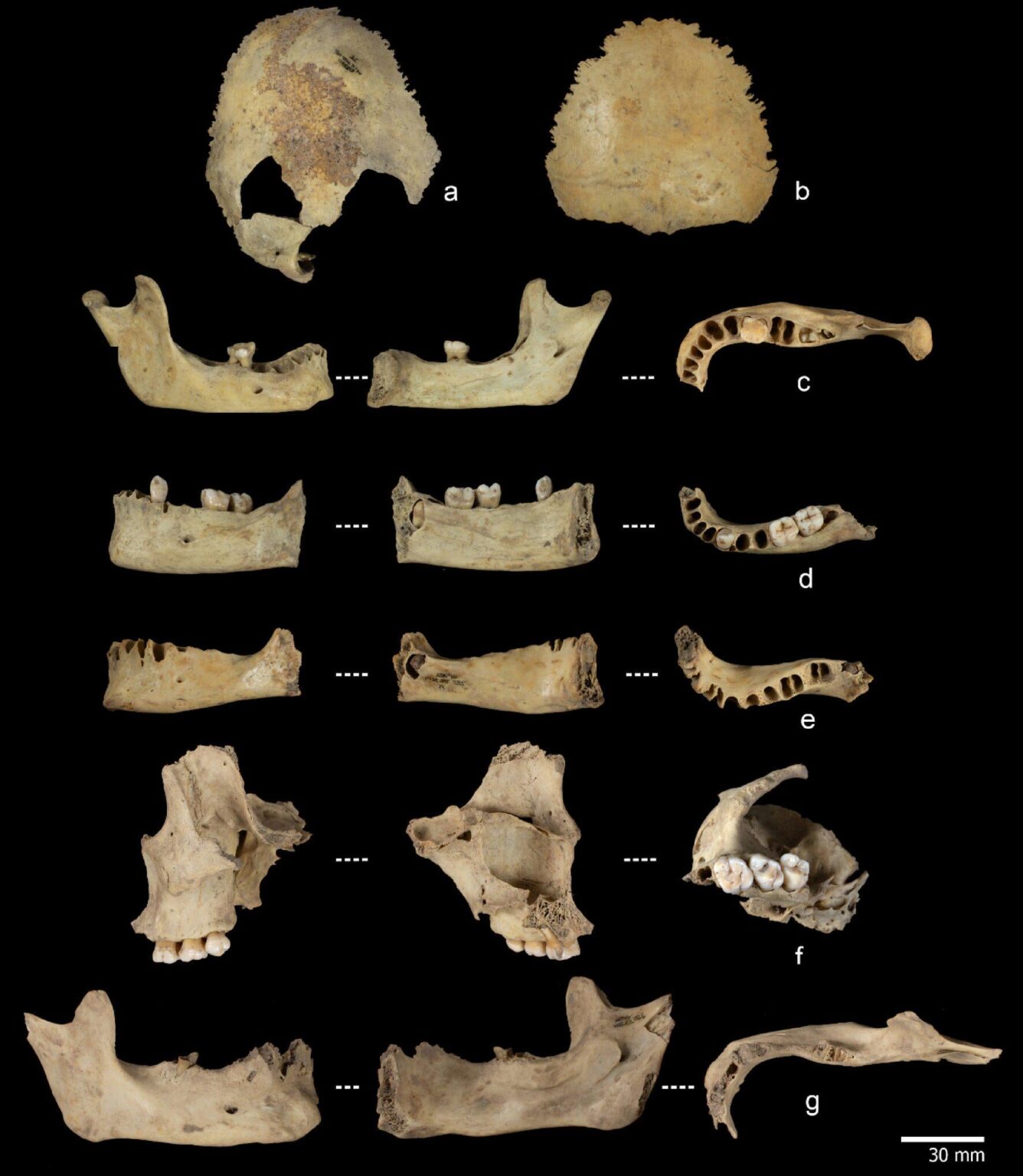 PHYS.Org: "Eating the competition? New evidence suggests Neolithic farmers cannibalized enemies"