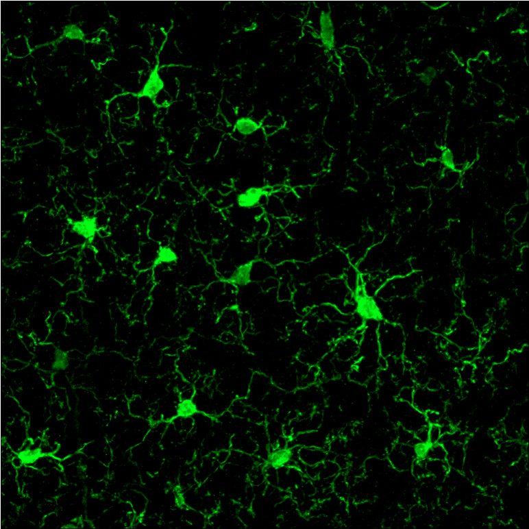 Will we ever be able to look back on Alzheimer's as a thing of the past?