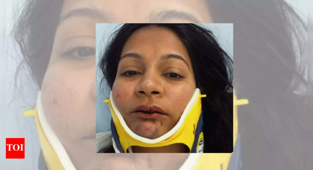‘I don’t feel like myself anymore’: Indian-origin couple’s story of being punched, kicked by Chinese man at Switzerland hotel goes viral 'I don't feel like myself anymore': Indian-origin couple's story of being punched, kicked by Chinese man at Switzerland hotel goes viral
