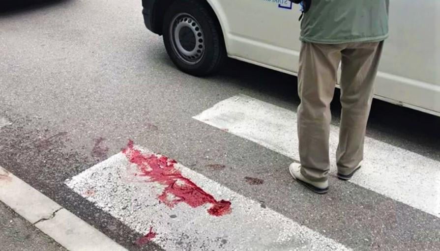 A doctor's vehicle in front of a police car and picked up a pedestrian on a zebra