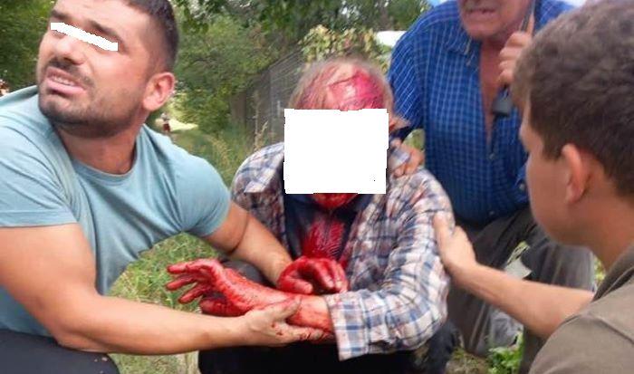 Man disfigured by bear in Ibanesti, Mures County