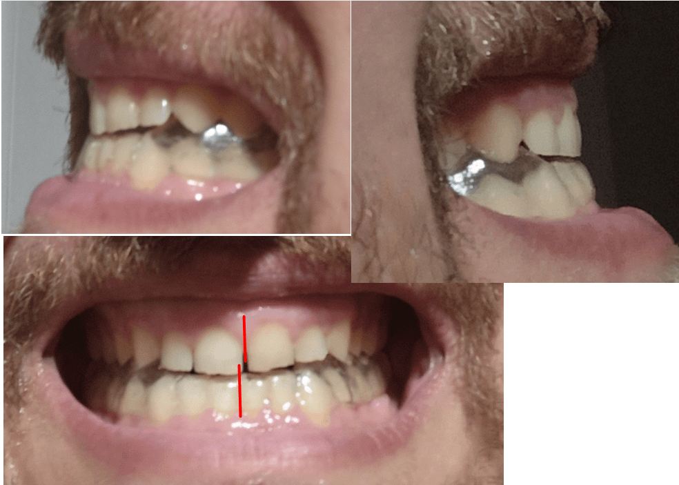 Horror Treatment of Jaw Joint at Elena in Dentaes (Appeal)