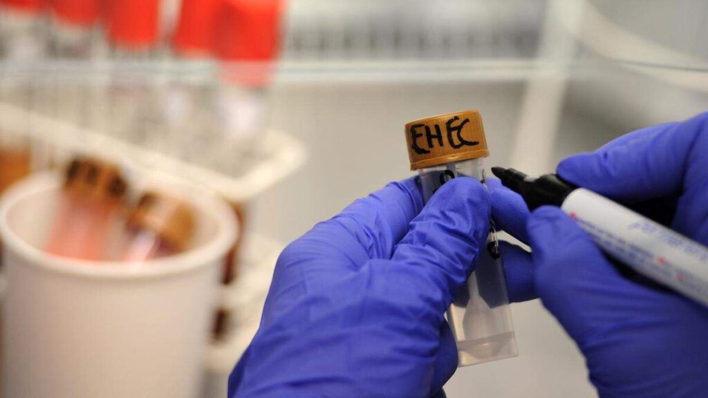 Luxembourg records 28 E. coli cases but sees ‘no conspicuous clusters’ Luxembourg records 28 E. coli cases but sees ‘no conspicuous clusters’