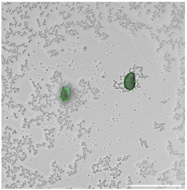 Bacteria that ‘shine a light’ on microplastic pollution - American Chemical Society