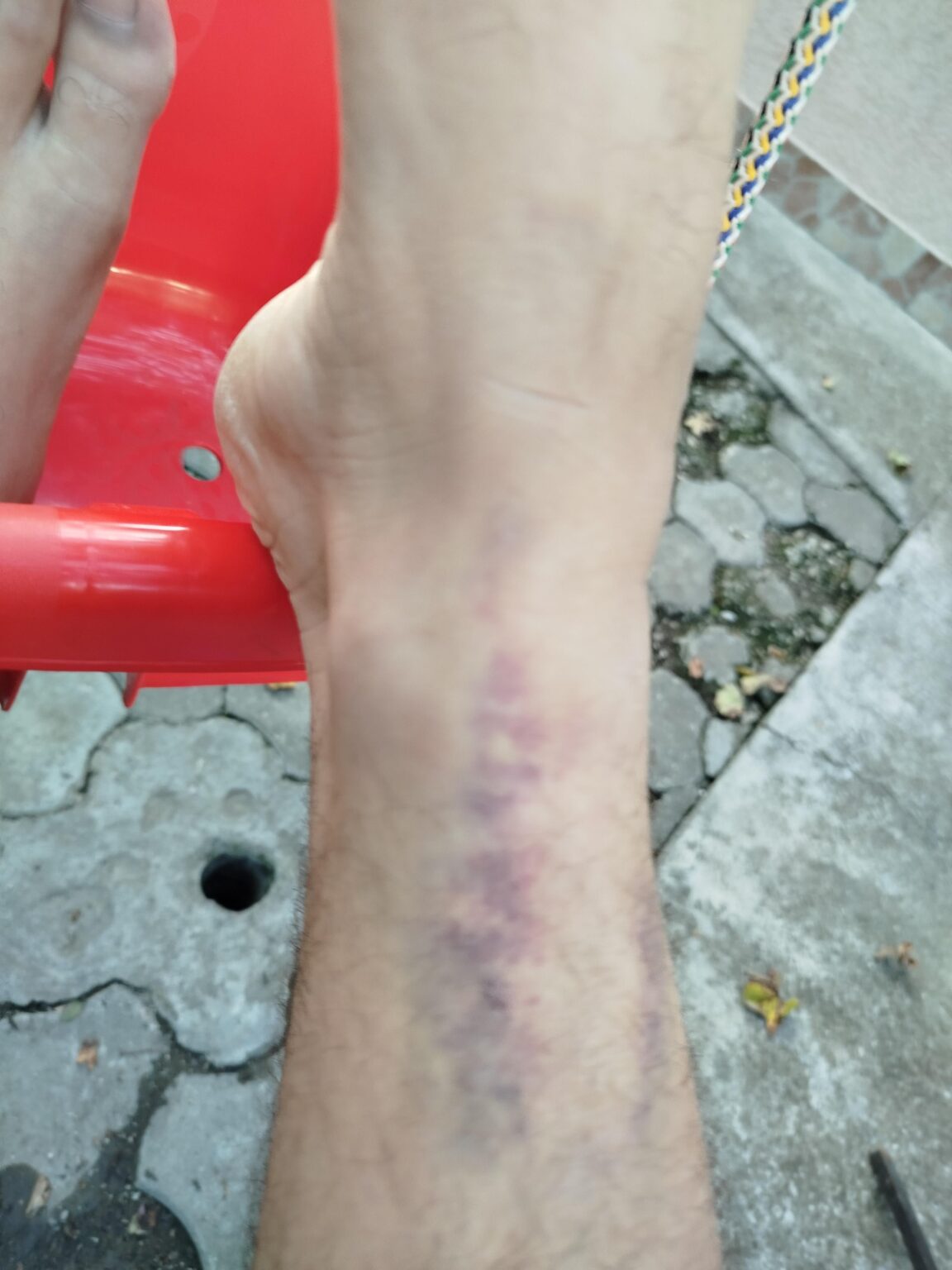 I dropped out of a window of a moving car
