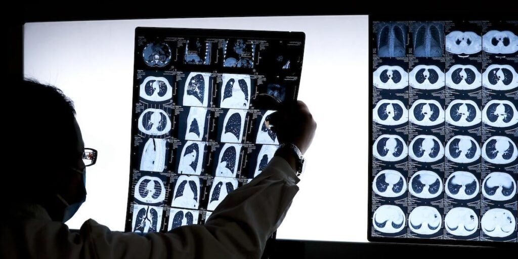 The tricks of hospitals to distort the waiting lists