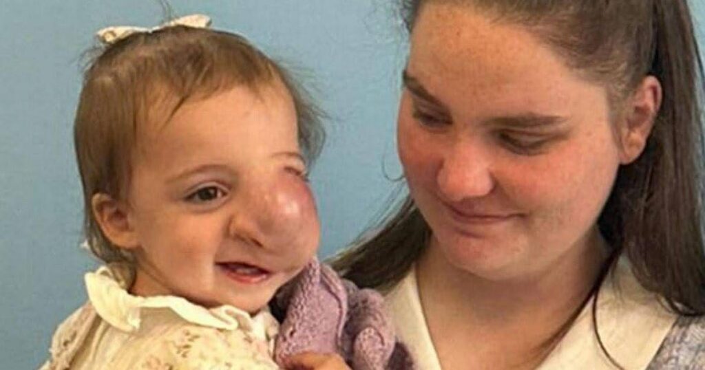 Little girl dies of cancer after doctors assume facial lump 'was caused by parents'