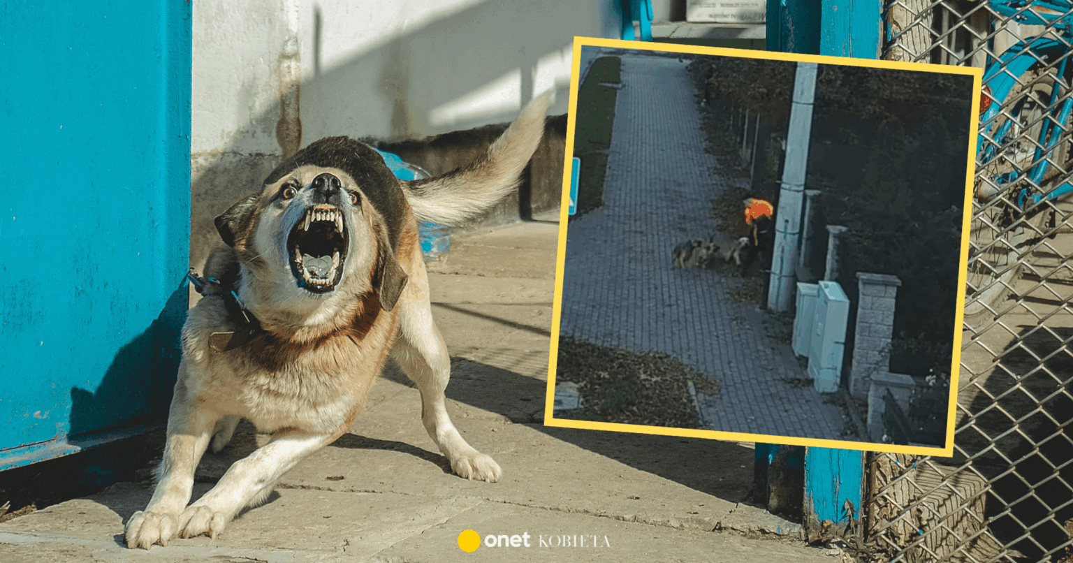 Aggressive dogs attacked the boy. The city police are looking for witnesses