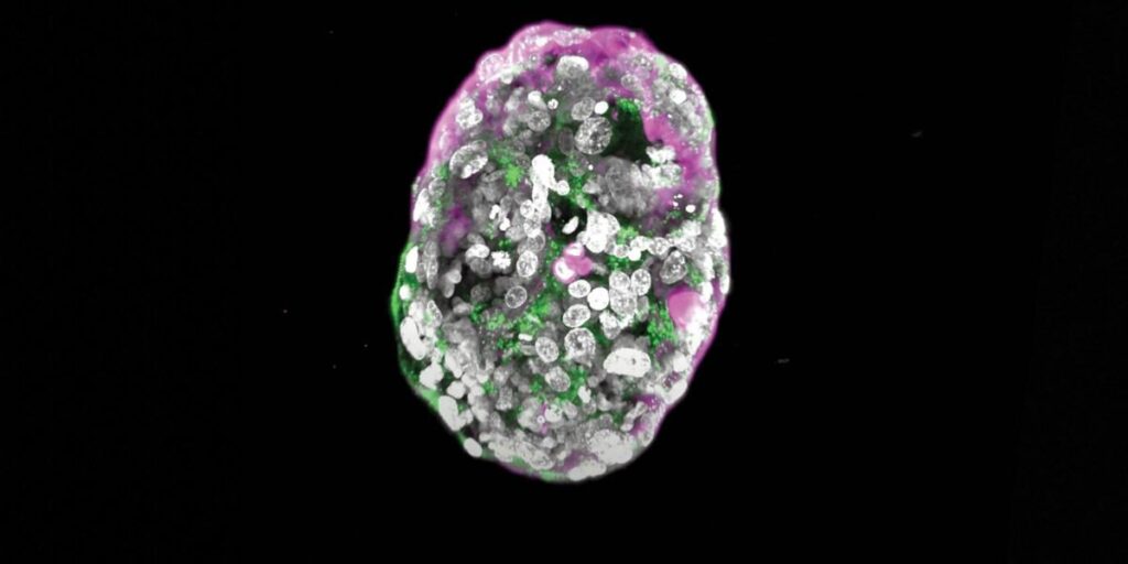 The astonishing embryo models of Jacob Hanna