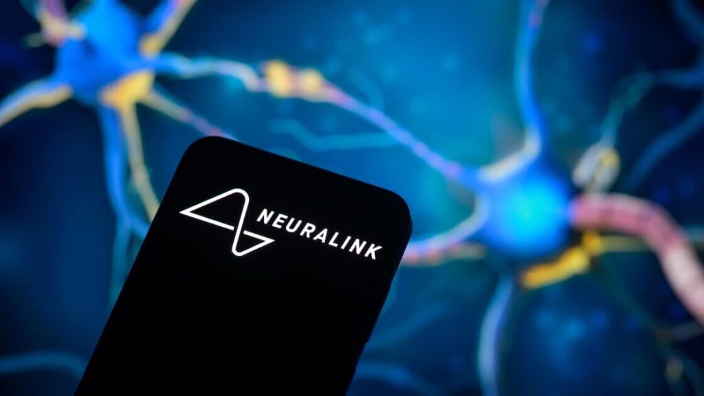 Neuralink: We Have a Backlog of 10K Patients Who Want Our Brain Implant