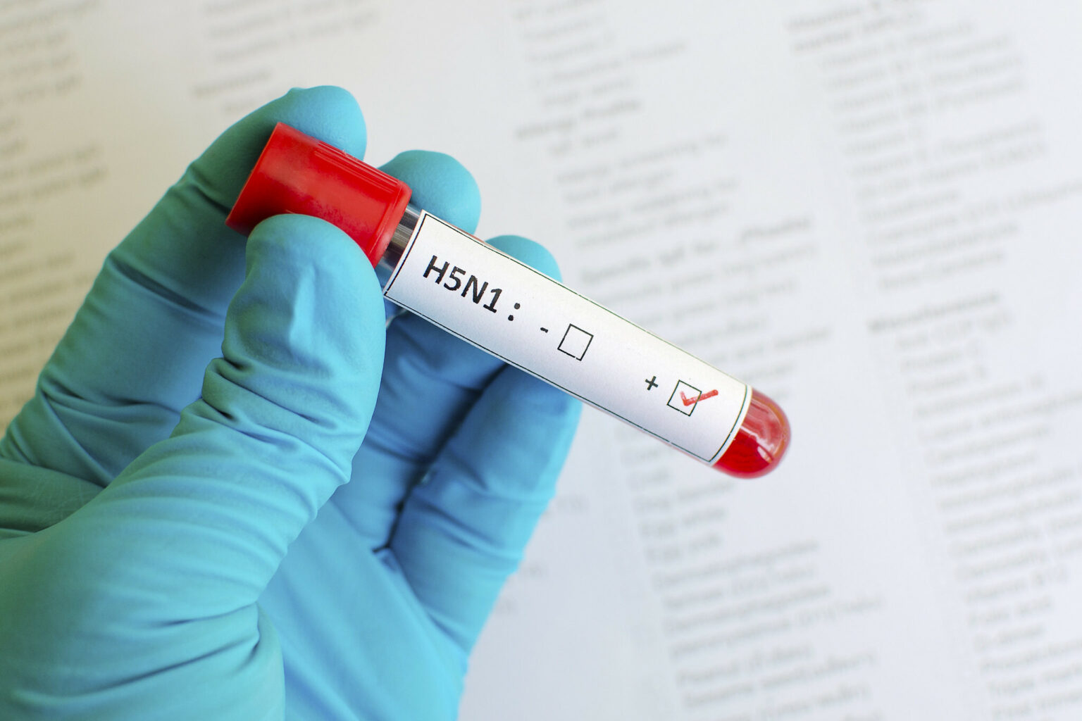 Slovakia reports bird flu outbreak on northern farm