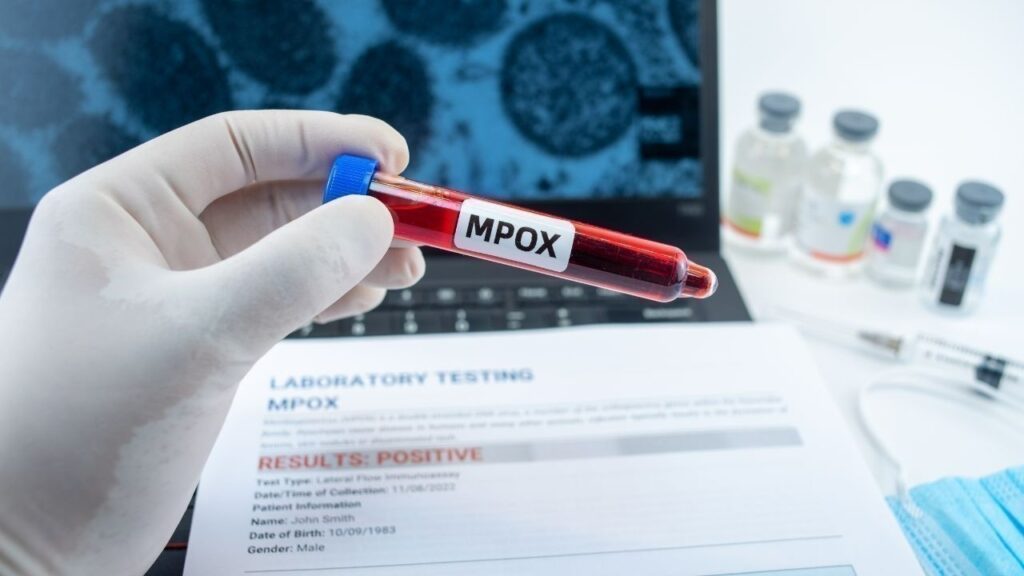 Mpox Variant