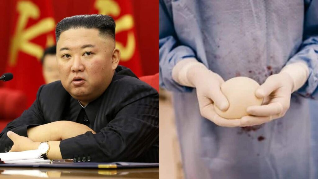 Why North Korea is cracking down on breast implants – Firstpost Why North Korea is cracking down on breast implants – Firstpost