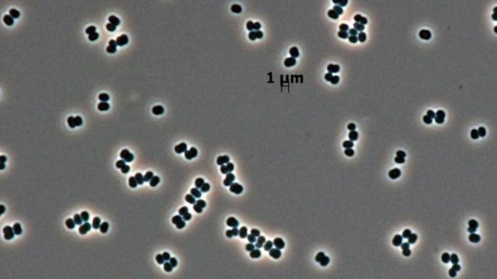 NASA discovered a bacteria that can ‘play dead’—and might have accidentally sent it to Mars | In a recent study, scientists have now worked out this sneaky bacterium’s secret: T. phoenicis can enter a state of deep hibernation—one that evaded detection despite rigorous sterlization for spacecrafts