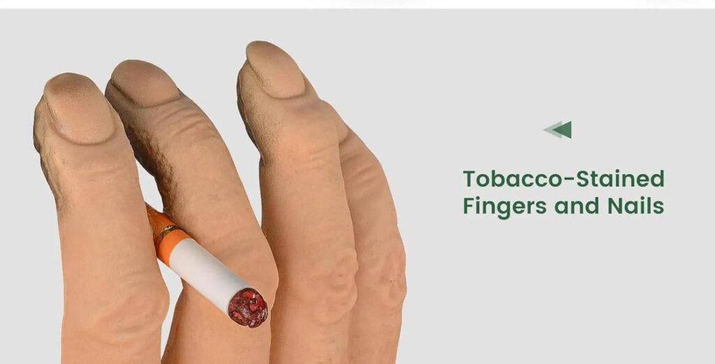 Stop taking donuts/ice cream/etc from sellers who don't wash their hands after smoking or handling dirty money