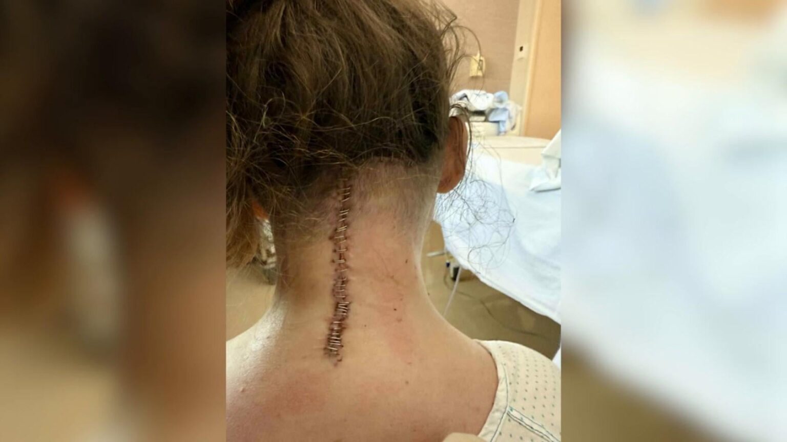 Christina got nine months left to live in – now she has been operated in Spain for her own expense Christina got nine months left to live in - now she has been operated in Spain for her own expense