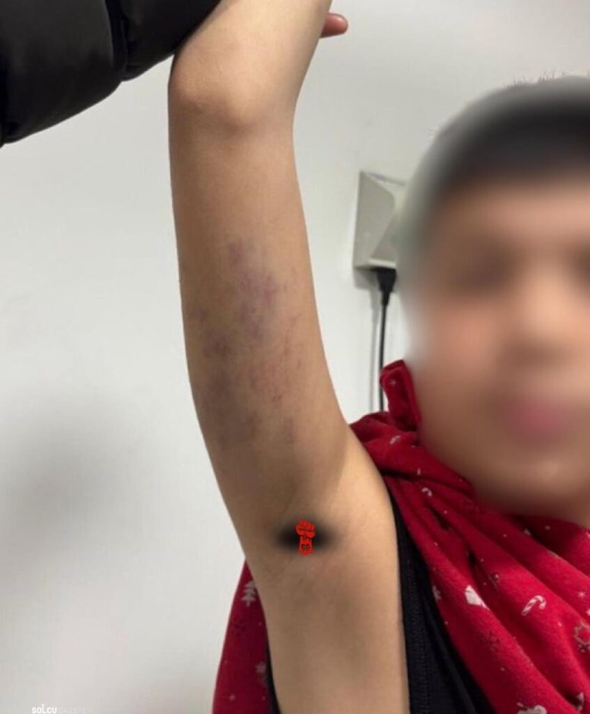 An autistic child was sexually abused and beaten at school.