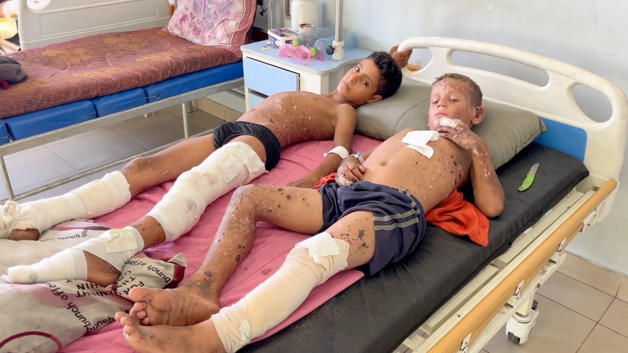 Zein Nour (left) and Joud Al-Anqar (right) recover in Shifa hospital in Gaza City after being wounded by explosive ordnance. October 28, 2025.
