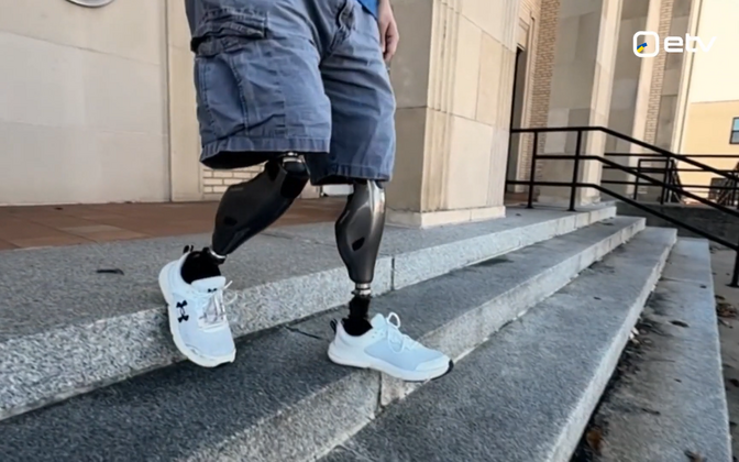 Estonia providing state-of-the-art prostheses for Ukrainian soldiers | News