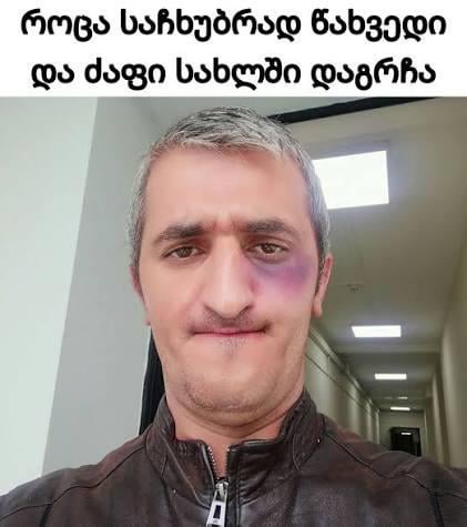 pepper spray and the so-called "Startovka" has been banned, from now on we wear a thread to protect ourselves