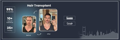 Top 10 Best Hair Transplant Clinics in Istanbul, Turkey for 2026 – Last Update