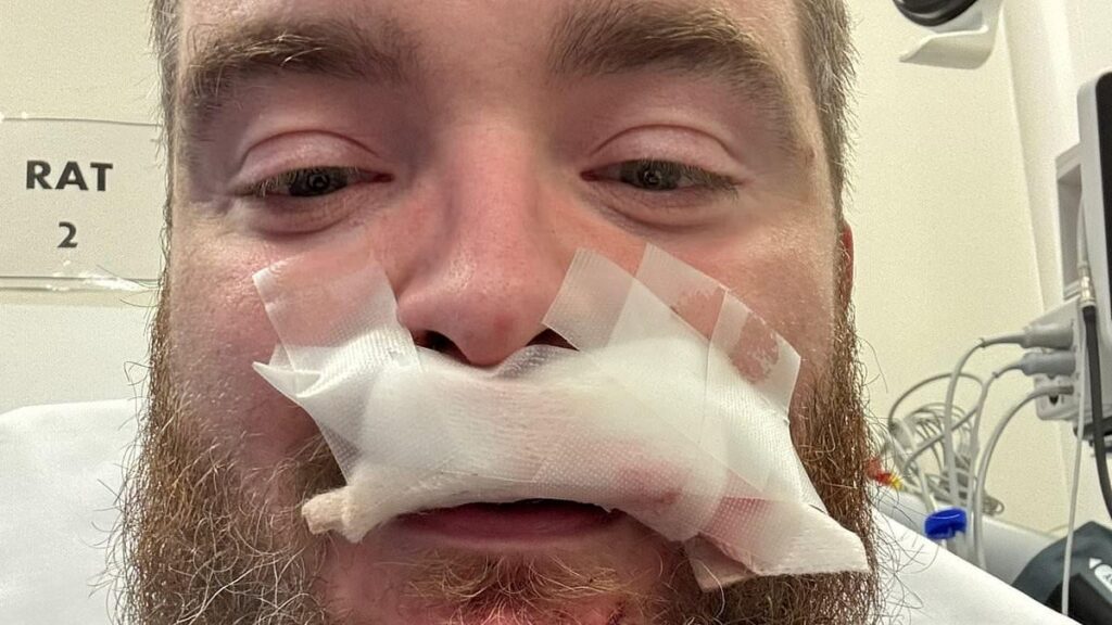 Huntingdon train knife rampage suspect 'slashed man in the face' a MONTH ago - as police re-open investigation they closed by text after just 48 hours