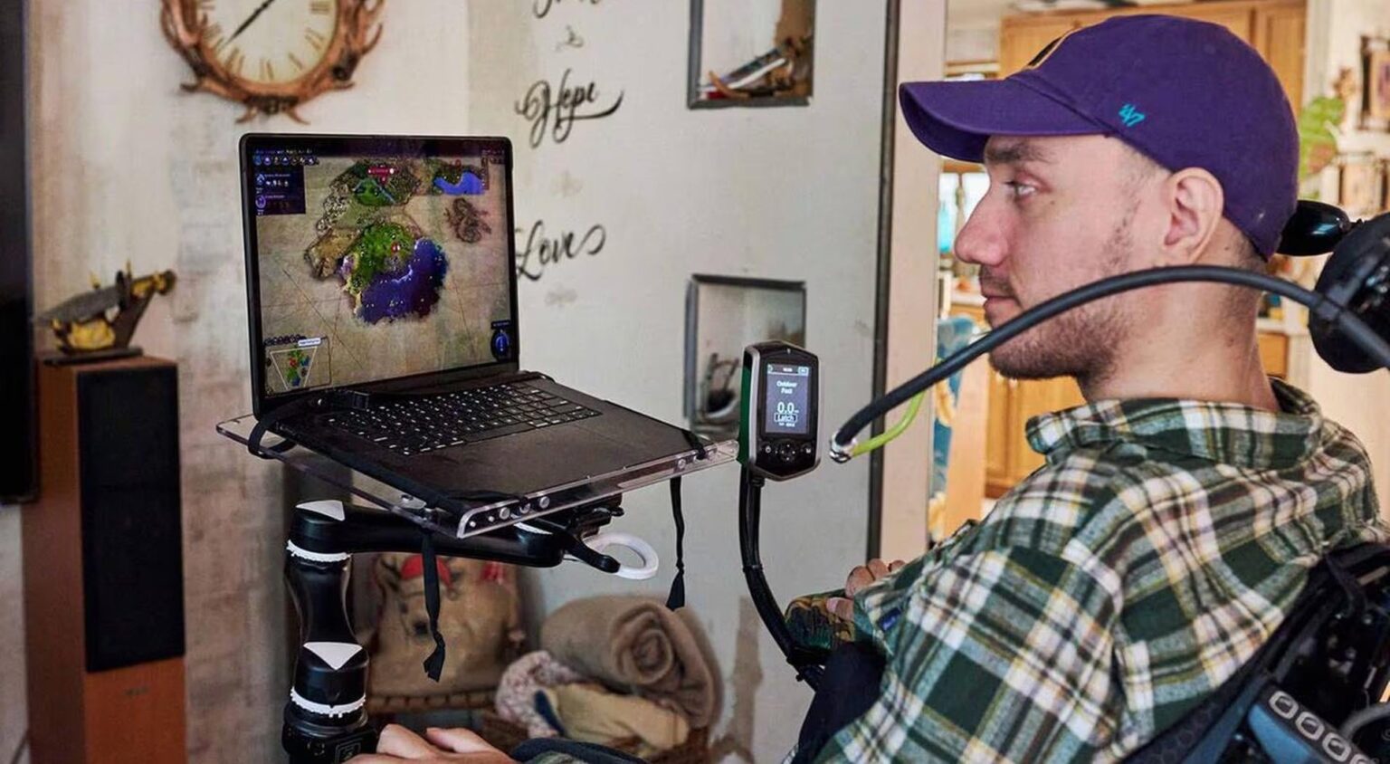 Neuralink plans to restore limb function for first patient with next chip implant