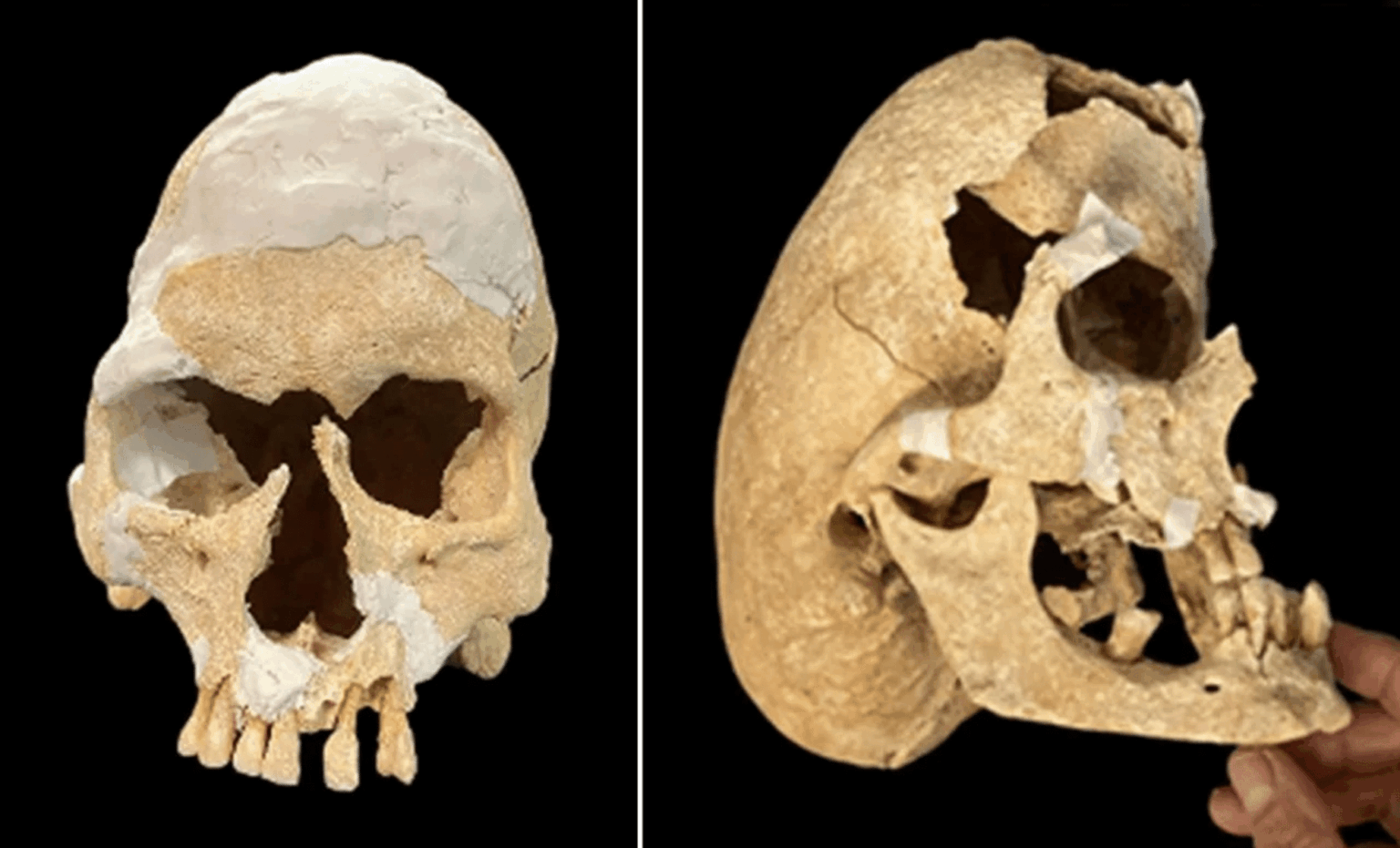 Medieval Warrior Monk With Rare Skull Shape Unearthed In Spain