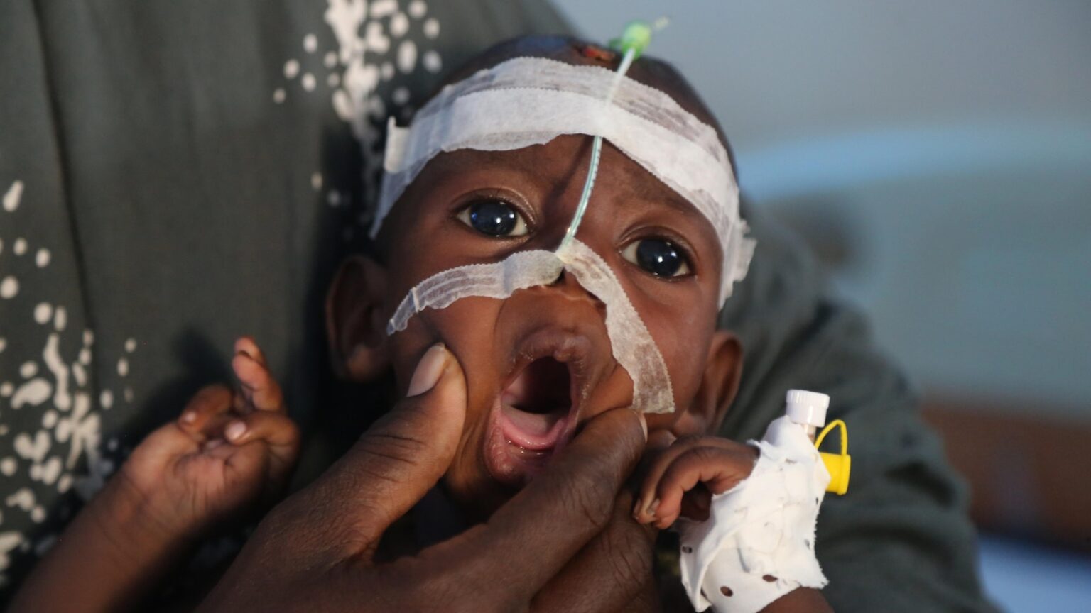 A visit to Somalia's crumbling hospitals shows the toll of aid cuts and war