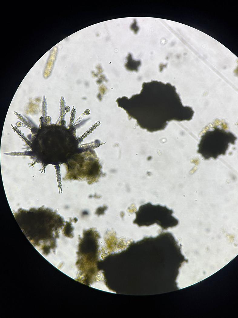 The batch of sea urchins being grown in Malta are still microscopic in size. Photo: Chris Sant Fournier