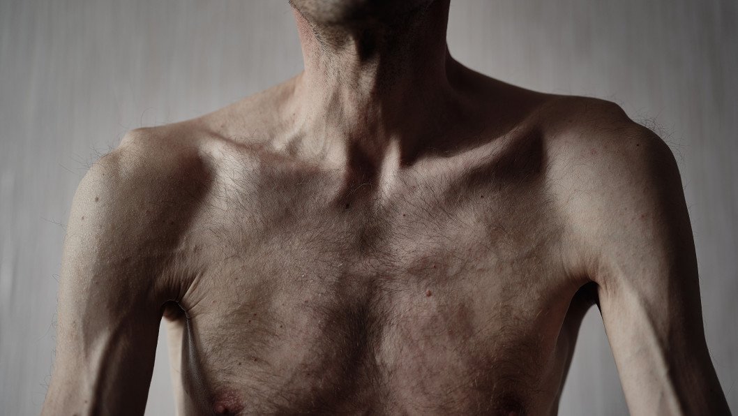 The “Gentleman’s Kit” of Torture: Firsthand Accounts Reveal Russia’s Brutal POW Abuse System