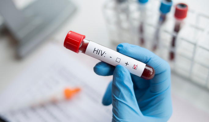 721 people currently living with HIV in Malta