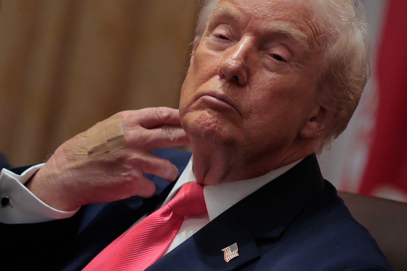 U.S. President Donald Trump wears adhesive bandages on the back of his hand during a meeting of his cabinet in the Cabinet Room of the White House on December 02, 2025 in Washington, DC.