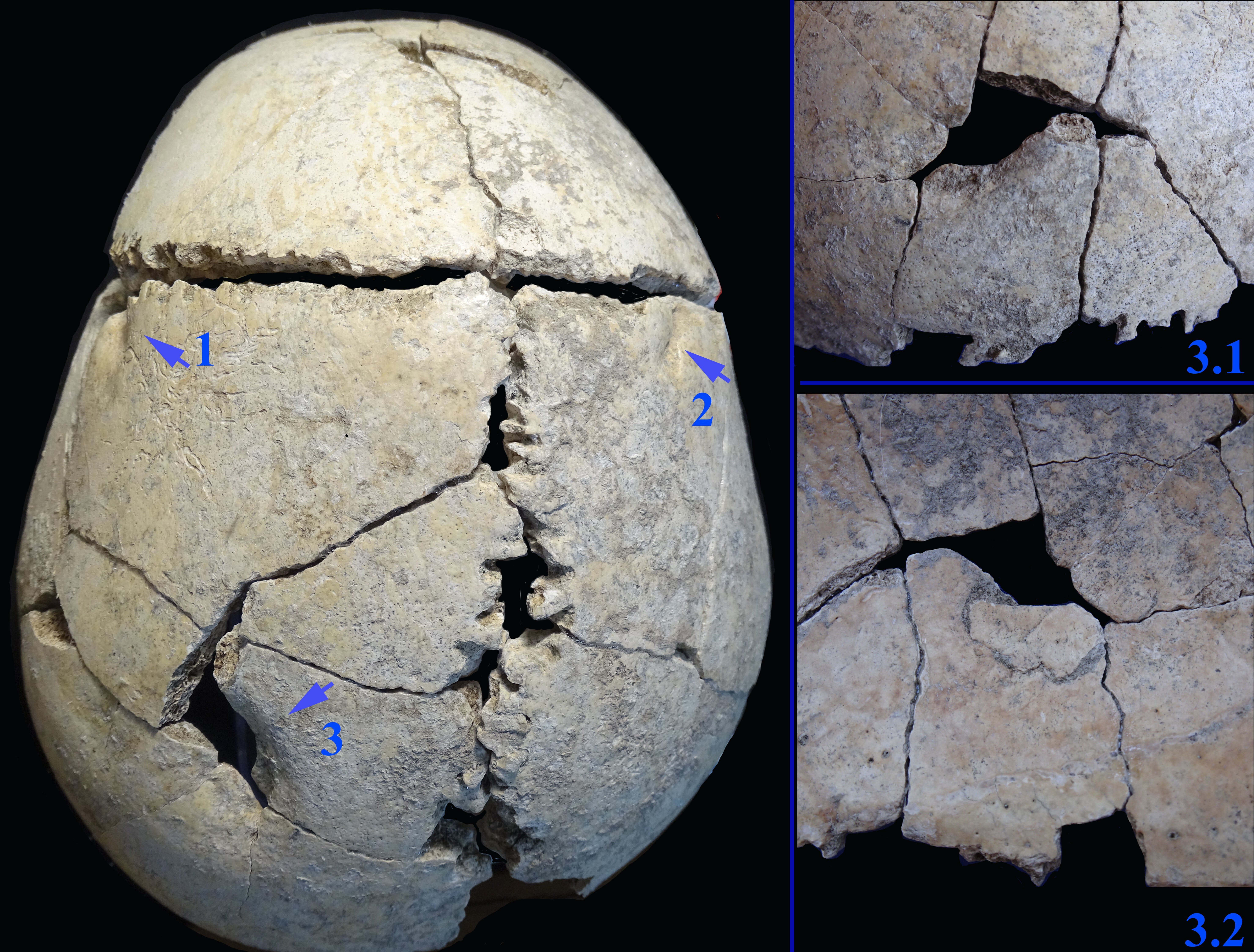 Image of the labeled pieces of the recovered skull.