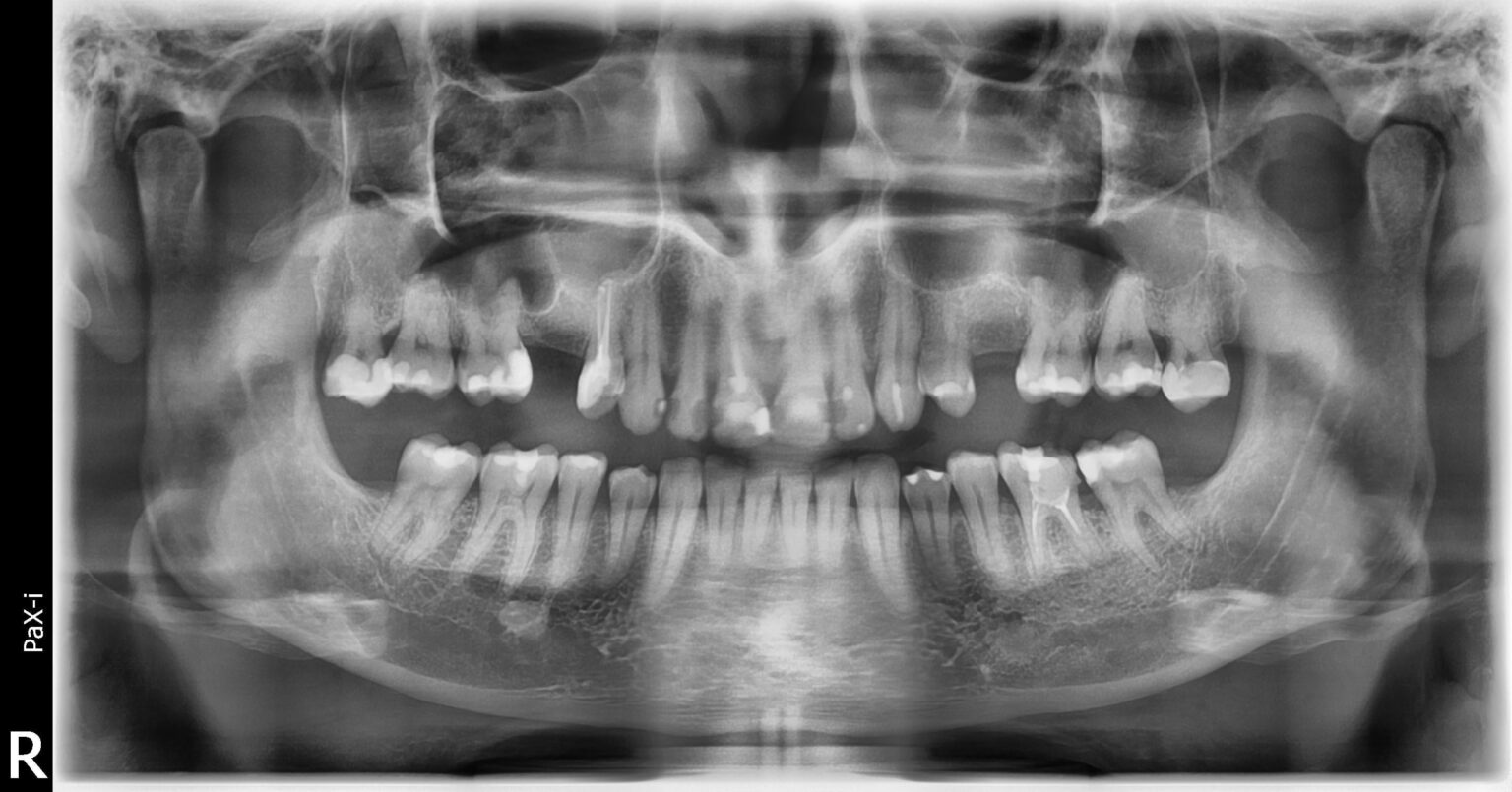 What do you think of going to smaller towns to get your teeth fixed?