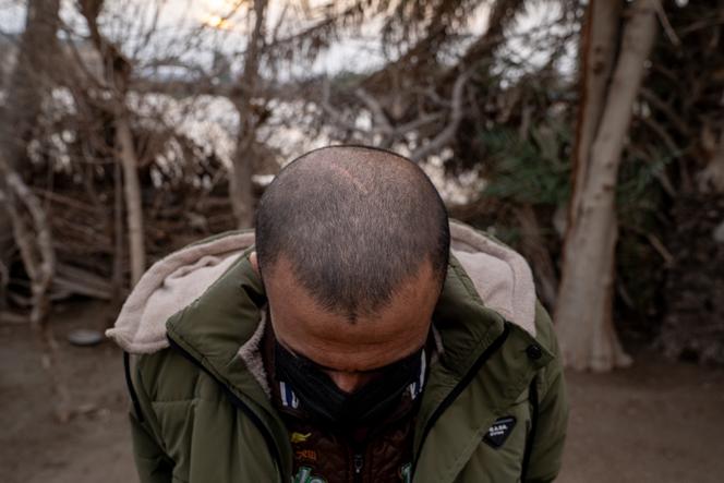 Ahmed Hussein (a pseudonym), age 25, whose skull was injured during torture sessions in detention, was staying with relatives in Northeast Syria on January 24, 2026.